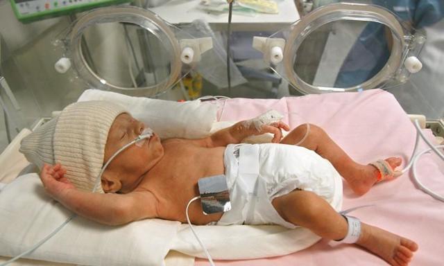 Асфиксия новорожденных: 5 механизмов развития, 3 степени тяжести