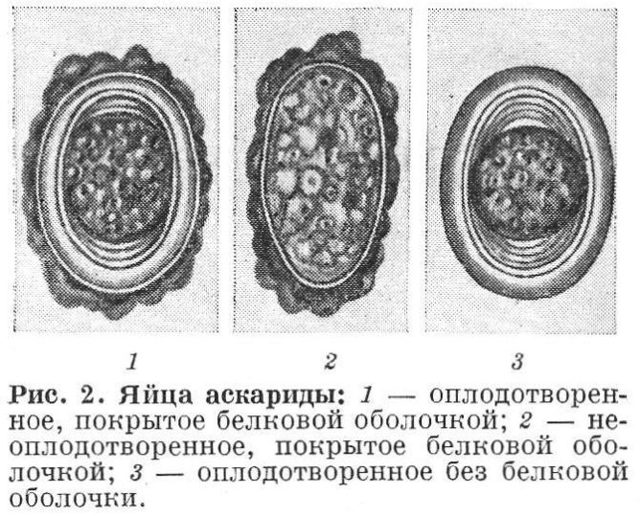 Аскариды у детей: пути заражения, 8 групп проявлений, 3 способа лечения
