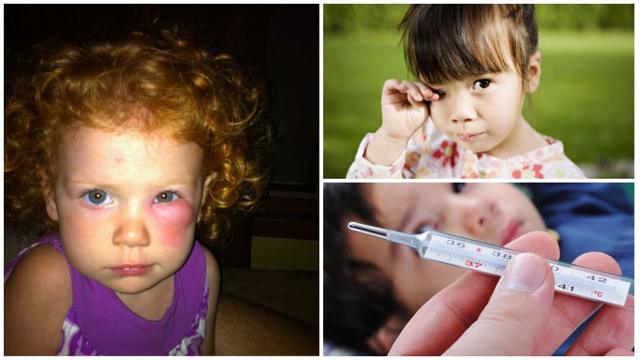 Чем для детских глаз опасны укусы комаров: глазной дирофилляриоз, лечение и профилактика