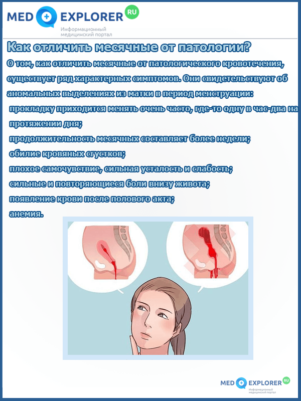 Чем кровотечение отличается от месячных