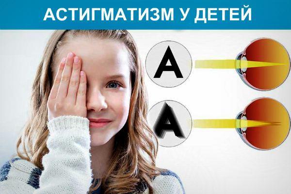 Дальнозоркий астигматизм у детей: 3 причины и 3 степени, 5 способов диагностики и лечения