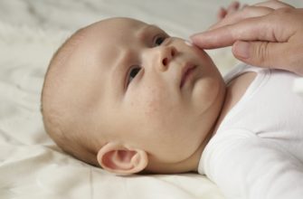 Детская экзема: 5 видов у детей, новорожденных и грудничков, 9 правил лечения