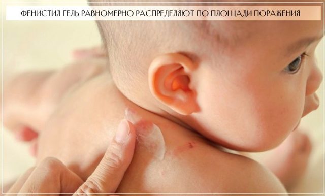 Фенистил при аллергии у ребенка: 10 советов аллерголога, применение, противопоказания, отзывы