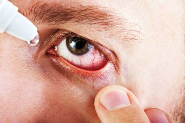 Глазные капли для улучшения зрения при близорукости и другие методы лечения