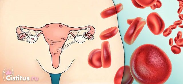 Как справиться с кровотечением при эндометриозе