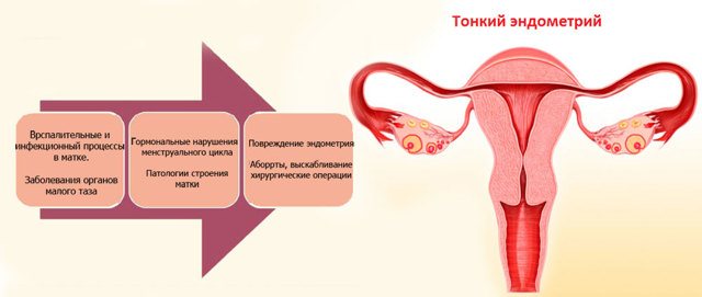 Как увеличить толщину эндометрия, чтобы забеременеть