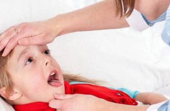 Лакунарная ангина у детей: 5 этапов лечения и советы от педиатра