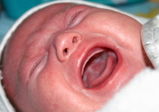 Молочница во рту у ребенка: причины, симптомы, способы лечения