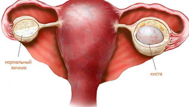 На какой день менструального цикла проводится УЗИ органов малого таза