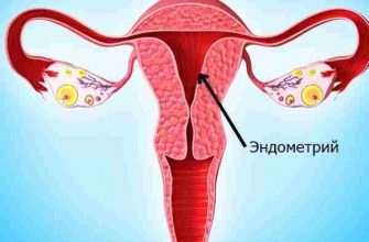 Неоднородная структура эндометрия: норма или патология