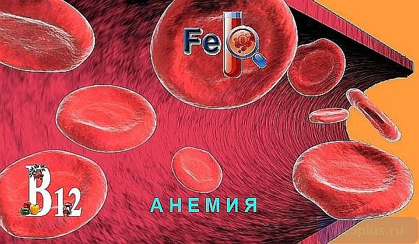 Низкий гемоглобин у ребенка: основные причины, 4 типа проявления и лечение анемии