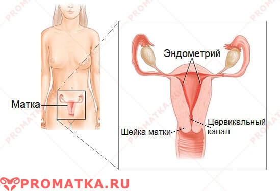Особенности выскабливания полости матки при гиперплазии эндометрия