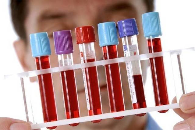 Повышенные тромбоциты в крови у ребенка: 4 причины, особенности сдачи анализа