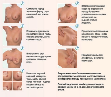 Причины боли в груди во время менструации