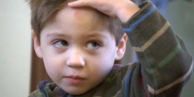 Резидуальная энцефалопатия у детей: 10 факторов развития, 4 симптома, методы лечения