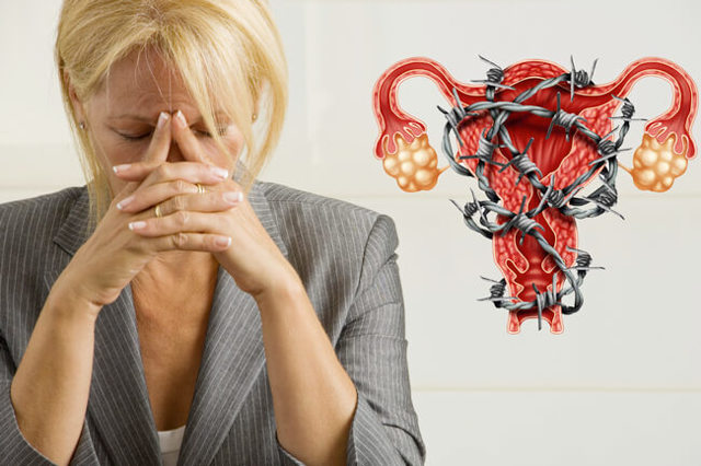 Симптомы и лечение миомы матки при менопаузе