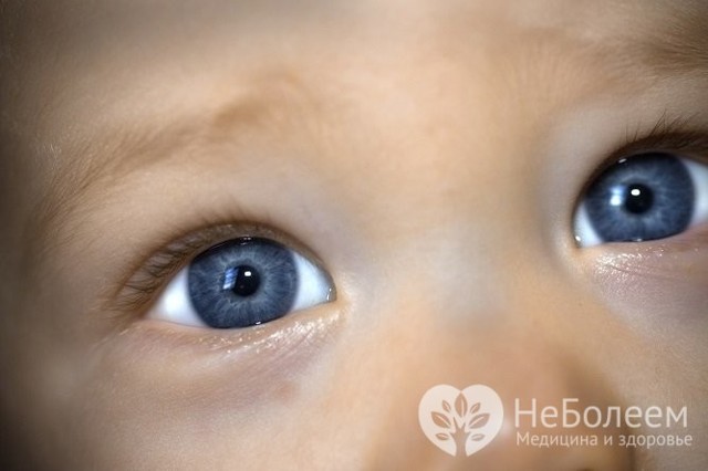 Синяки под глазами у ребенка: 12 возможных причин, методы лечения и профилактики