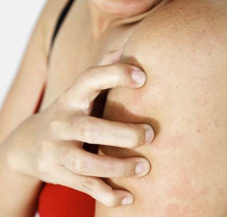 Сухая кожа при климаксе: как устранить и предупредить зуд