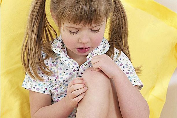Ювенильный ревматоидный артрит у детей: симптомы, лечение, профилактика, препараты