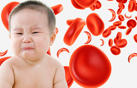 Железодефицитная анемия у детей: 4 группы причин, симптомы, 5 подходов к лечению
