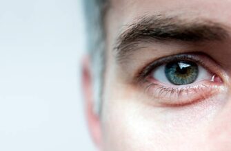 Синдром «сухого глаза»
